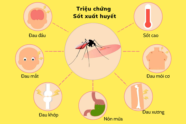 Các triệu chứng sốt xuất huyết